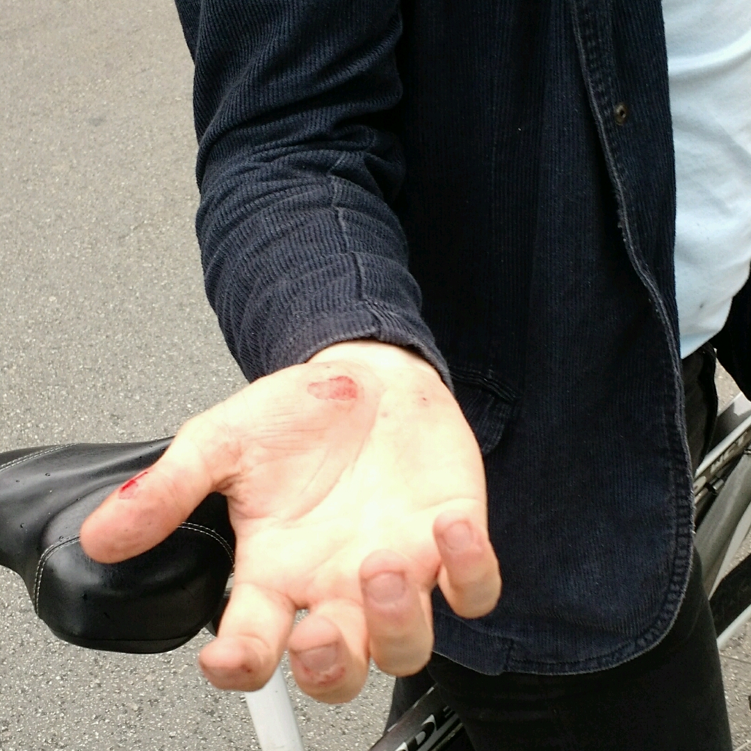 Fietser_gewond